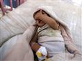طفل يمني يشتبه باصابته بالكوليرا في احد مستشفيات ص