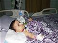 جراحة ناجحة لطفلة عمرها عام ولدت بكبد وأمعاء خارج البطن (2)                                                                                                                                             