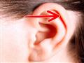 بعض أجزاء الأذن                                                                                                                                                                                         