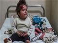 لأكثر من مئة طفل بحاجة لرعاية طبية عاجلة في الغوطة