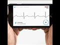 تطبيق AliveCor