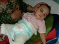 الطفلة خديجة تعاني ما بها من امراض وإجراء العمليات