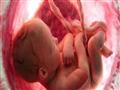 4 وضعيات للجنين قبل الولادة تعرفي عليها                                                                                                                                                                 