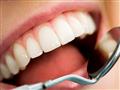هل السكري يسبب تساقط الأسنان؟