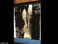 صورة الأشعة تكشف الهيكل العظمي للغزال                                                                                                                                                                   