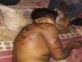 3 - أثار التعذيب على جسد أحد المصريين                                                                                                                                                                   