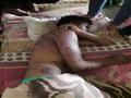 4 - صورة أخرى لأثار التعذيب على أحد المصريين                                                                                                                                                            