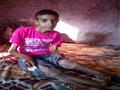 محمد وإصابات متكررة عند ذهابه للمدرسة بسبب طبيعة مرضه                                                                                                                                                   