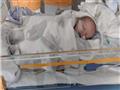 الطفل أوليفار أثناء علاجه من الهربس