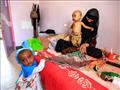 طفل اخر يعاني سوء التغذية في صنعاء على سرير في مست