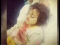 مأساة الطفلة جوري بعد عملية اللوز 