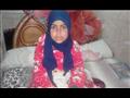 الطفلة اسماء إبراهيم عنيصر المصابة بمرض الروماتيدم