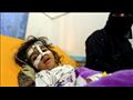 طفلة يمنية تتلقى العلاج من الكوليرا في العاصمة الي