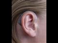 الطريقة الصحيحة للعناية بسماعة الأذن الطبية