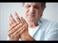 أسباب وأعراض التهاب مفاصل الأصابع