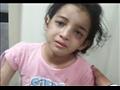 الطفلة هبة ضحية تعذيب زوجة أبيها