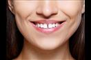 فراغات الأسنان- هل نقص الكالسيوم سببها الرئيسي؟
