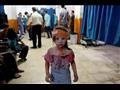 طفلة سورية مصابة في مستشفى ميداني في دوما شرق دمشق