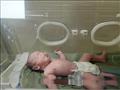 عملية ولادة قيصرية داخل مستشفى عزل كورونا