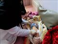 ممرضة تعالج طفلا يعاني من سوء التغذية في مستشفى ال