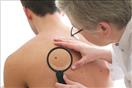أين يتطور سرطان الجلد ؟ 