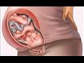 ماذا تعني أوضاع الجنين المختلفة في بطن أمه؟