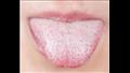 وجود بقع بيضاء أو حمراء أو داكنة لا تختفي في الفم
