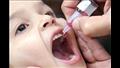 تطعيم شلل الأطفال                                 