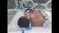 ولادة نادرة بمستشفى في أسيوط