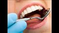 عمليات حشو عصب الأسنان