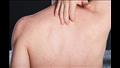علامات تحذيرية تكشف أنك مصاب بسرطان الجلد