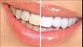 أفضل أنواع معجون أسنان لإزالة الجير والتبيض