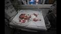 ولادة طفلة بعد استشهاد والدتها في قصف إسرائيلي