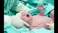 ولادة طفل "حامل" في شقيقه التوأم في تونس