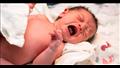 عالميا.. 2.3 مليون رضيع يتوفون خلال الشهر الأول من الولادة سنويا