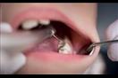 4 أنواع لأشعة الأسنان- ما الفرق بينهم؟