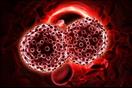 أعراض سرطان الدم الليمفاوي