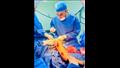 نجاح أول جراحة لتركيب مسمار تليسكوبى لطفل مصاب بالعظام الزجاجية في بني سويف