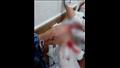 إصابة طالب في مشاجرة بالأسلحة البيضاء
