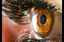 يصيب العين- تحذيرات من وباء قد يجتاح العالم 