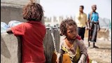 اليمن يشهد ثالث أكبر أزمة غذاء في العالم