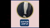 طب طنطا تنجح في إعادة توصيل يد مبتورة بعد 3 ساعات من فصلها (2)