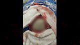 مستشفى ملوي التخصصي ينقذ طفلة من الموت (3)