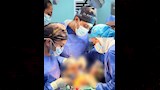 إزالة ورم من فك مريضة