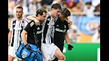 إصابة لاعب يوفنتوس