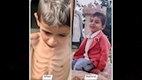 كيف حوّل الاحتلال الغذاء إلى سلاح حرب بغزة؟ (11)