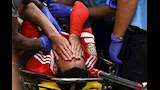 لقطة إصابة جمال موسيالا (3)