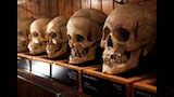 متحف أمريكي يعرض 35 ألف قطعة من بقايا البشر (2)