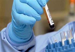 لجنة الفيروسات الكبدية: أدوية فيروس سي أثبتت فاعليتها في علاج كورونا