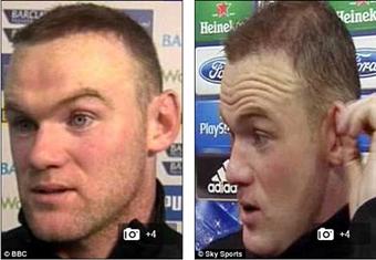 الديلي ميل: روني دائم التردد على أطباء التجميل